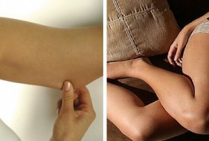 Strakkere armen en benen met deze tips en oefeningen