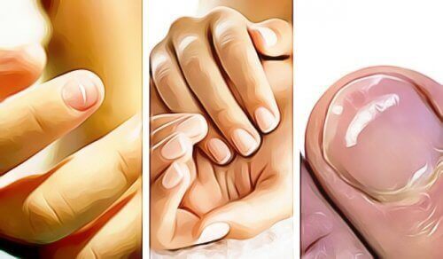 Vijf dingen die je nagels je vertellen over je gezondheid