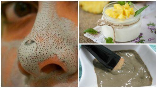 5 fantastische maskers om de huid te zuiveren van mee-eters