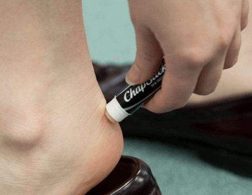 Lippenbalsem tegen blaren