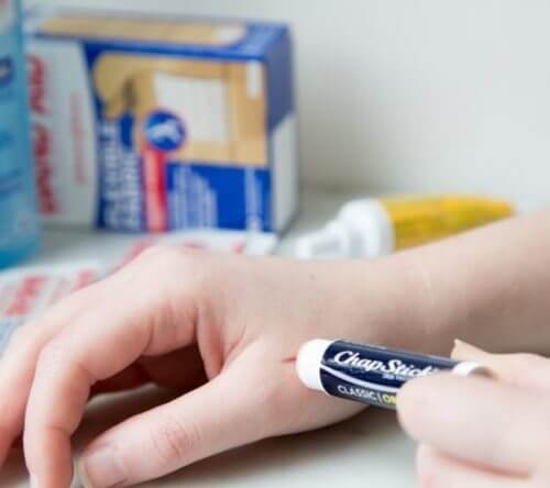 Lippenbalsem op wondje