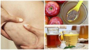 Bestrijd cellulite met honing en appelazijn