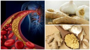 Krachtige remedie tegen hoge bloeddruk en cholesterol