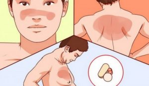 Wat je moet weten over lupus