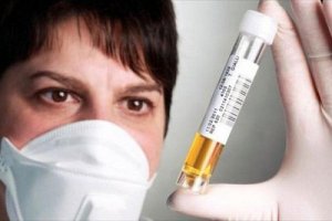 Het verband tussen je gezondheid en de kleur van je