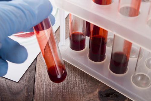 Kanker kan nu door middel van bloedonderzoek sneller worden opgespoord