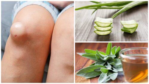 De 5 beste remedies om van kniezwellingen af te komen