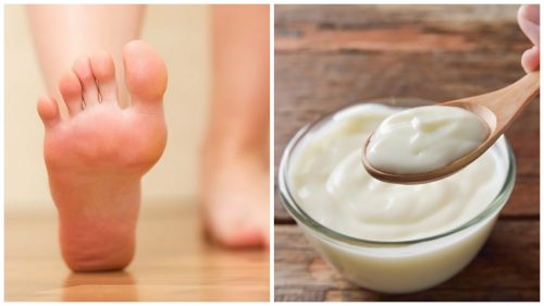 Huismiddeltje van yoghurt en azijn om eelt onder je voeten te verwijderen