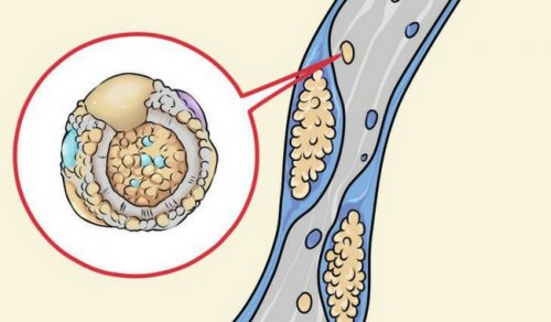 Verlaag je cholesterol door deze 6 strategieën te gebruiken in de keuken