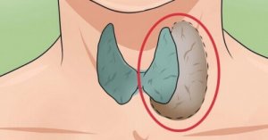 14 symptomen van schildklierproblemen