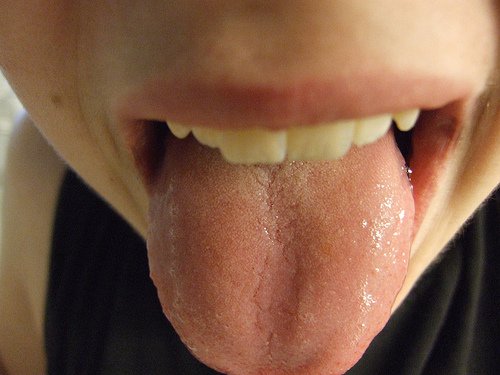Blaren en rode puntjes op de tong