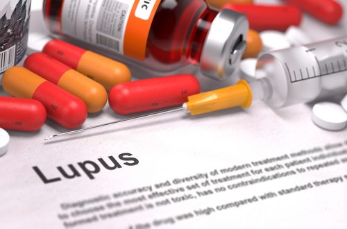 Lupus en medicatie