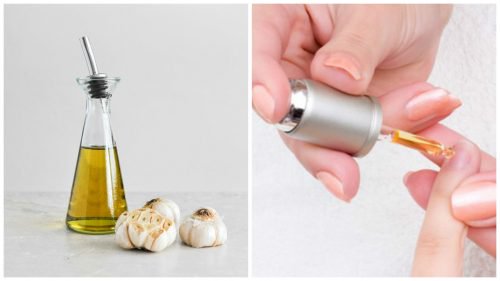 Je nagels versterken met zelfgemaakte lotion