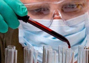 Een simpele bloedtest zou een tumor kunnen lokaliseren