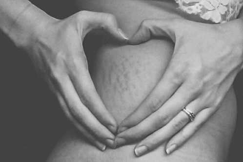 acceptatie