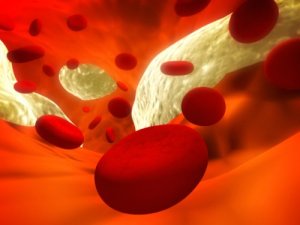 Atherosclerose: 12 remedies om deze aandoening te voorkomen