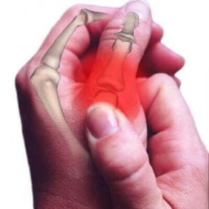 Ontwikkelingen in de behandeling van osteoartritis