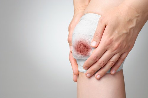 Wond in verband