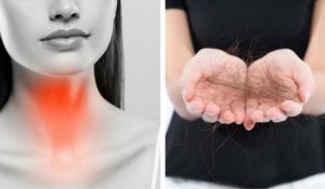 8 dingen die je kan doen tegen haaruitval door schildklierproblemen