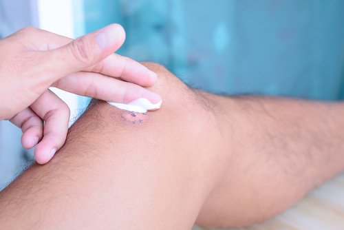 Wondje op de knie