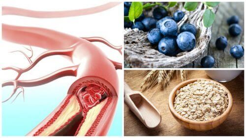 9 voedingsmiddelen voor gezonde slagaderen