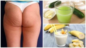 Verminder cellulitis met deze 6 natuurlijke alternatieven