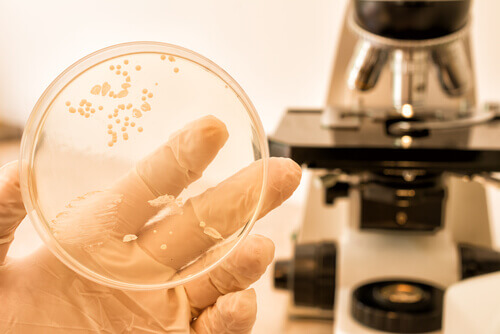 Diagnose en behandeling van candidiasis
