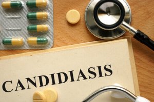 De behandeling van candidiasis : een aantal essentiële aandachtspunten