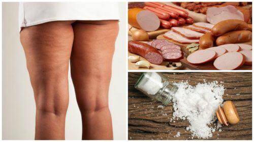 Cellulitis voorkomen: vermijd deze 7 voedingsmiddelen