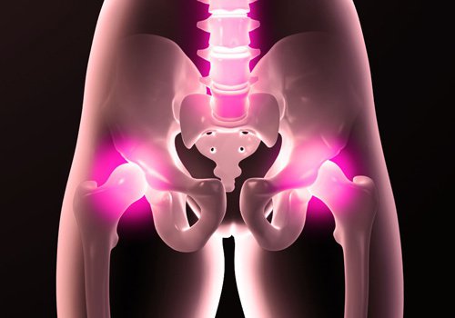 Heupaandoeningen de achtergrond