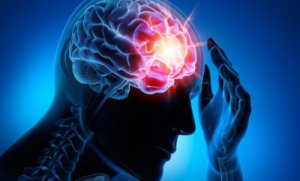 De vier meest voorkomende cerebrovasculaire aandoeningen