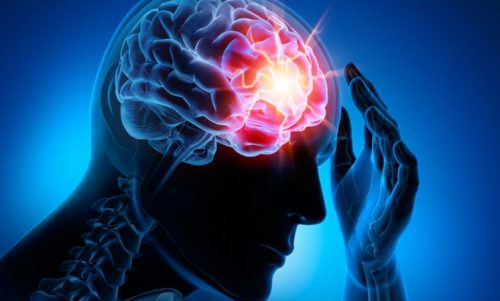 De vier meest voorkomende cerebrovasculaire aandoeningen