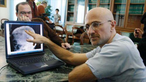 Hoofdtransplantatie een ongekende uitdaging voor de wetenschap