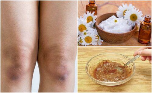 5 exfolianten om de huid van je knieën te behandelen
