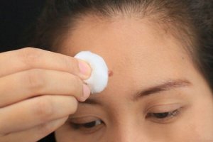 6 interne problemen die de puistjes op je gezicht kunnen onthullen