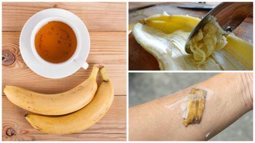 Vijf manieren om bananenschillen te gebruiken als natuurlijk geneesmiddel