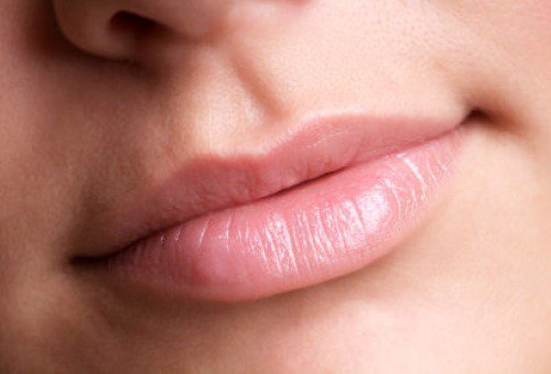 De vorm van je lippen kan een duidelijke V hebben