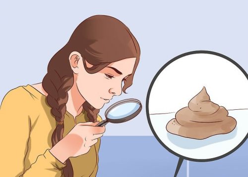 Wat zeggen de vorm en de kleur van je stoelgang over je gezondheid?