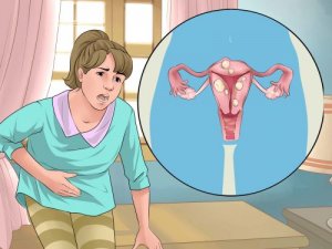 Behandel krampen tijdens de menstruatie met natuurlijke remedies