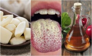 Hoe beheers je Candida Albicans met zes natuurlijke middelen?