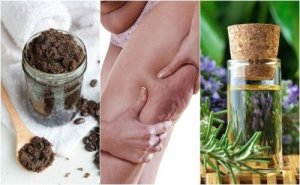 Vijf natuurlijke middelen tegen cellulitis: probeer ze!