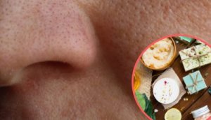 Grote poriën verkleinen met 8 natuurlijke middelen