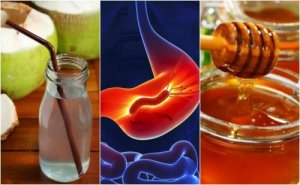 Probeer deze geweldige natuurlijke remedies tegen gastritis