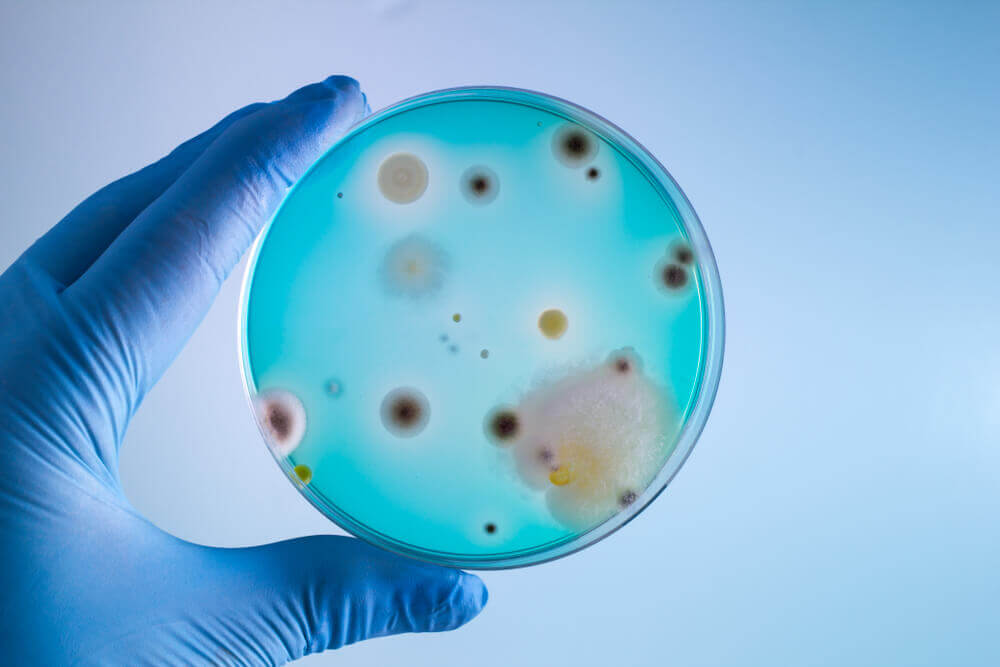 Kijk uit voor deze 9 gevaarlijke bacteriën die schadelijk zijn voor mensen