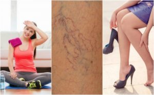 8 dingen die je kunt doen om een spinnenkop te voorkomen