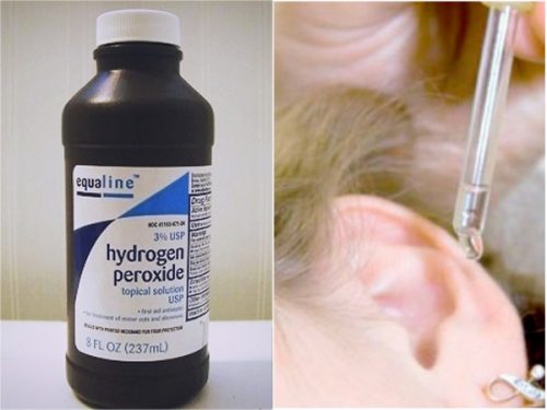 Water uit je oren krijgen met waterstofperoxide