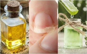 Zwakke nagels repareren: 5 natuurlijke remedies