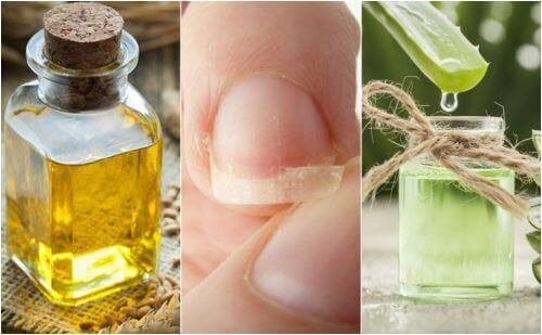 Zwakke nagels repareren: 5 natuurlijke remedies