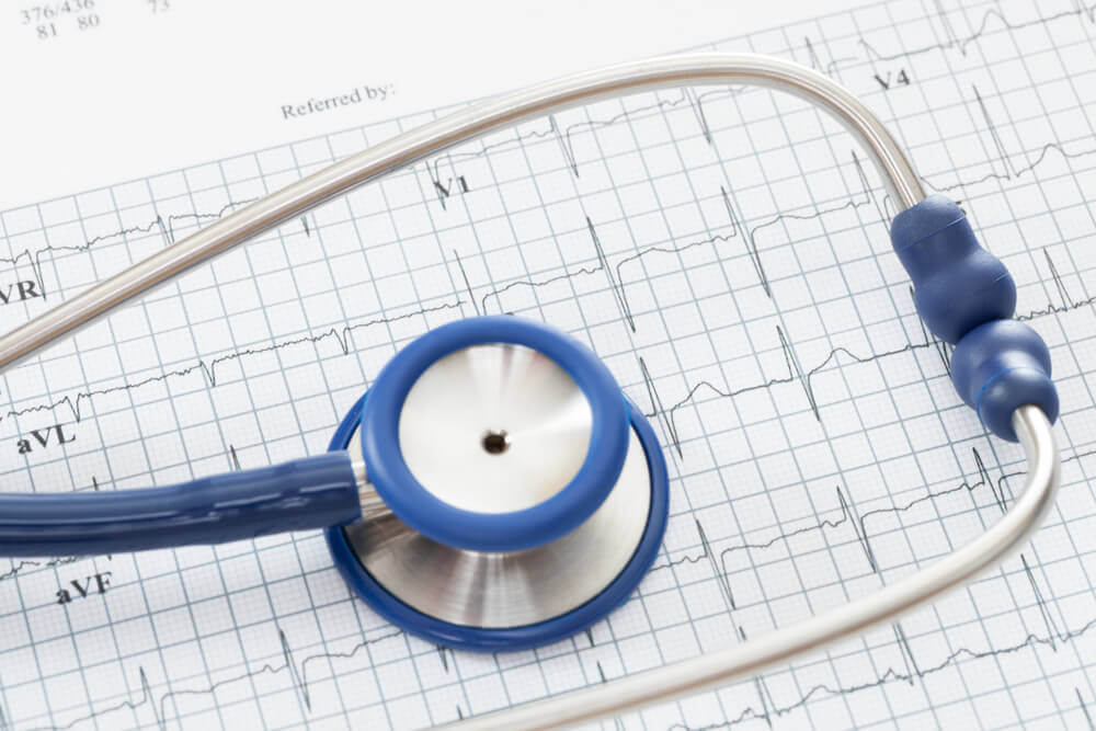 Cardiogram maken bij hartkloppingen