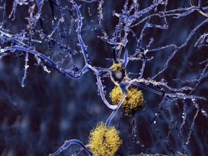 Vormen van dementie naast Alzheimer